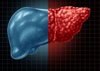 عادات النوم السيئة وأطعمة قد تصيبك بالكبد الدهني