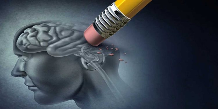 دراسة تهدم تصورات سائدة عن مرض ألزهايمر