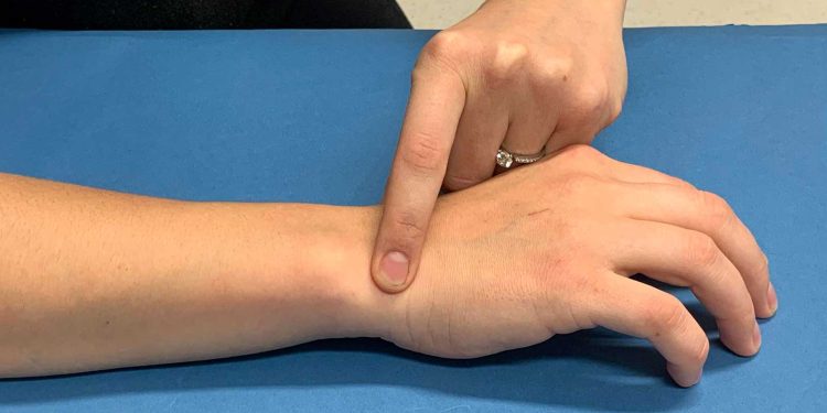 علماء يتنبؤون باحتمالية الوفاة من خلال المعصم