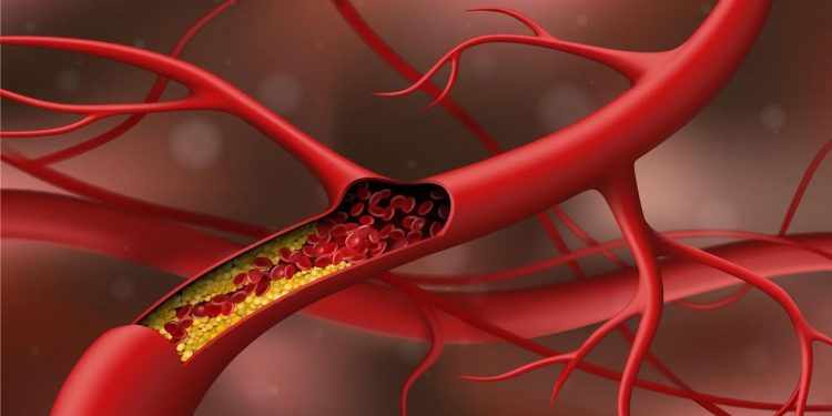 دراسة حديثة تكشف مفاجأة بشأن الكوليسترول المفيد