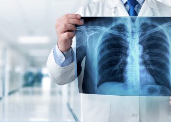 فحص بالأشعة يرصد مخاطر النوبة القلبية قبل حدوثها بـ 10 سنوات