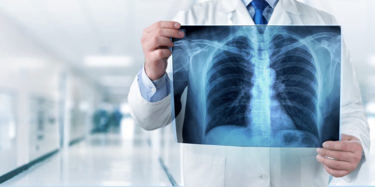 فحص بالأشعة يرصد مخاطر النوبة القلبية قبل حدوثها بـ 10 سنوات