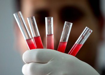 فصيلة دم نادرة .. لا يمتلكها سوى 43 شخصاً بالعالم