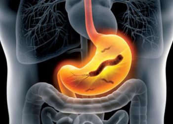 الأسبرين وجرثومة المعدة… علاقة معقدة في التسبب بقروحها