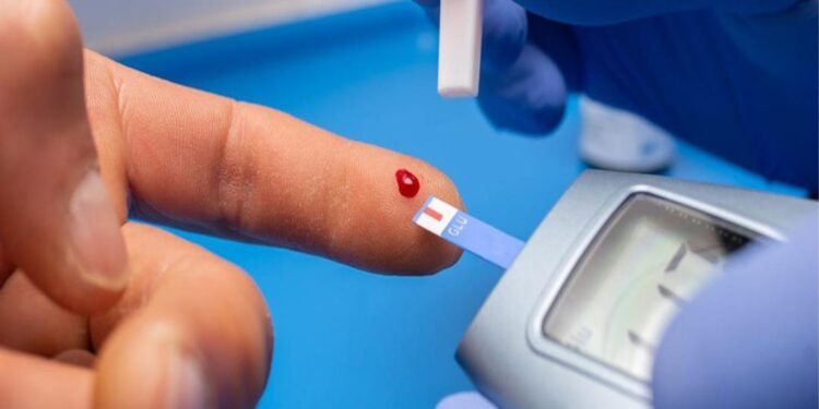 أعراض تظهر على الوجه تحذر من الإصابة بالسكري