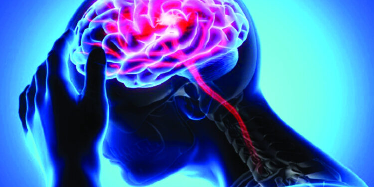 قطرات أنف تعالج السكتة الدماغية!