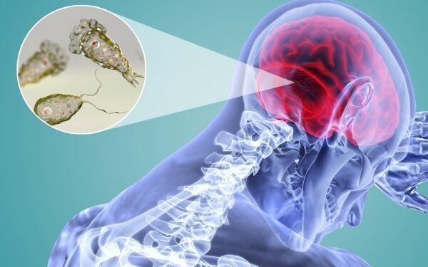 ضحية جديدة لمرض “الأميبا الآكلة للدماغ”