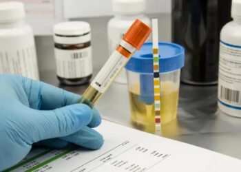 7 طرق لخفض حمض اليوريك في الجسم.. تعرف إليها